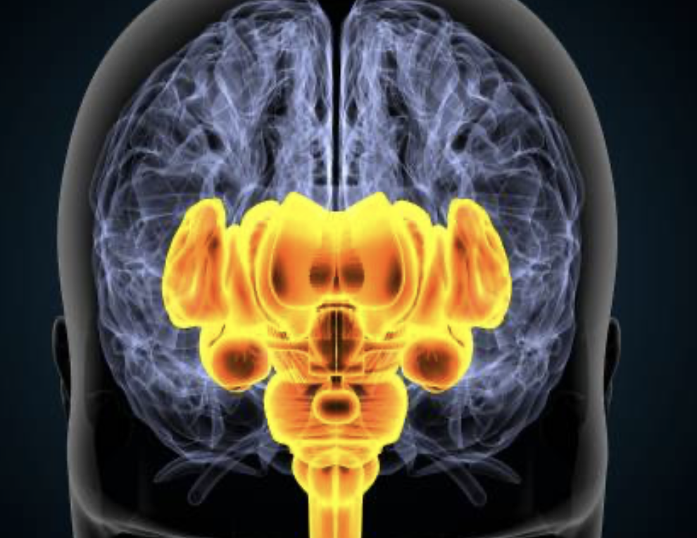 Brain Scan